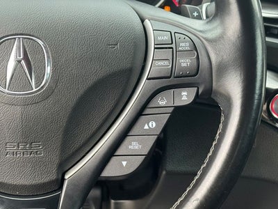 2021 Acura ILX Technology & A-Spec Packages